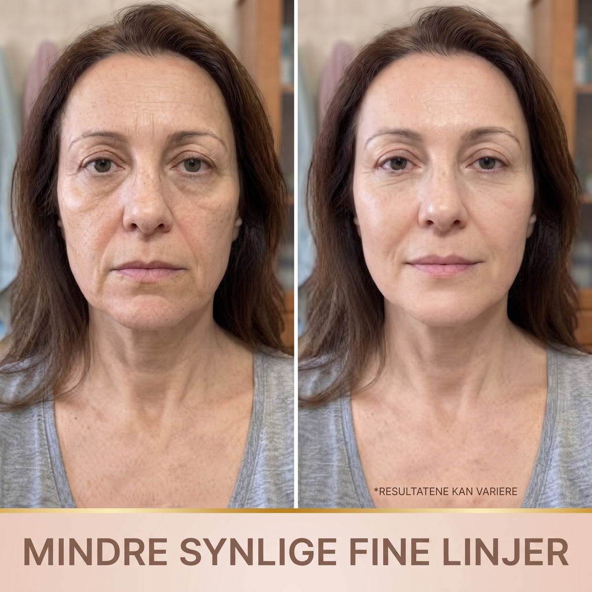 Lindray – Koreansk serum med løfteeffekt fra første påføring