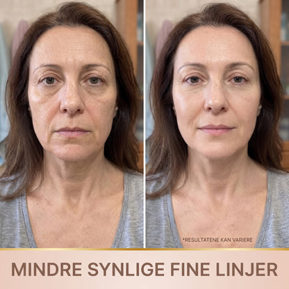 Lindray – Koreansk serum med løfteeffekt fra første påføring