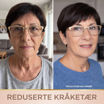 Lindray – Koreansk serum med løfteeffekt fra første påføring