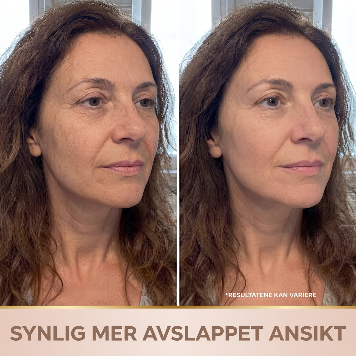 Lindray – Koreansk serum med løfteeffekt fra første påføring