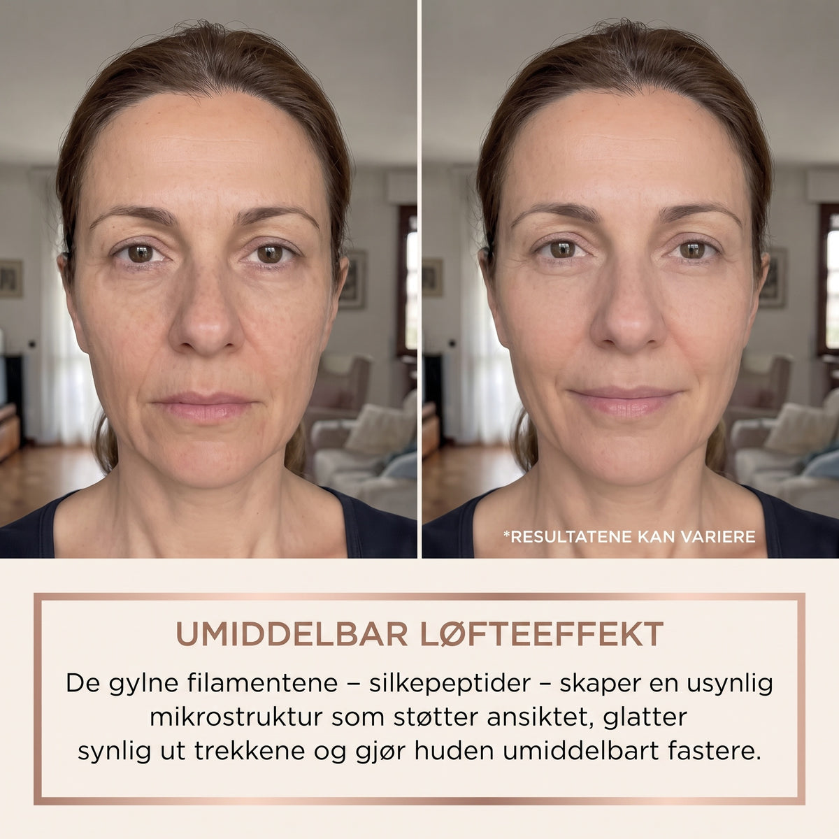 Lindray – Koreansk serum med løfteeffekt fra første påføring